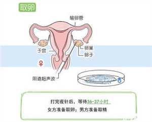 宁波哪里可以做代孕手术,2022石家庄能做第三代试管婴儿吗？有纳入医保吗？